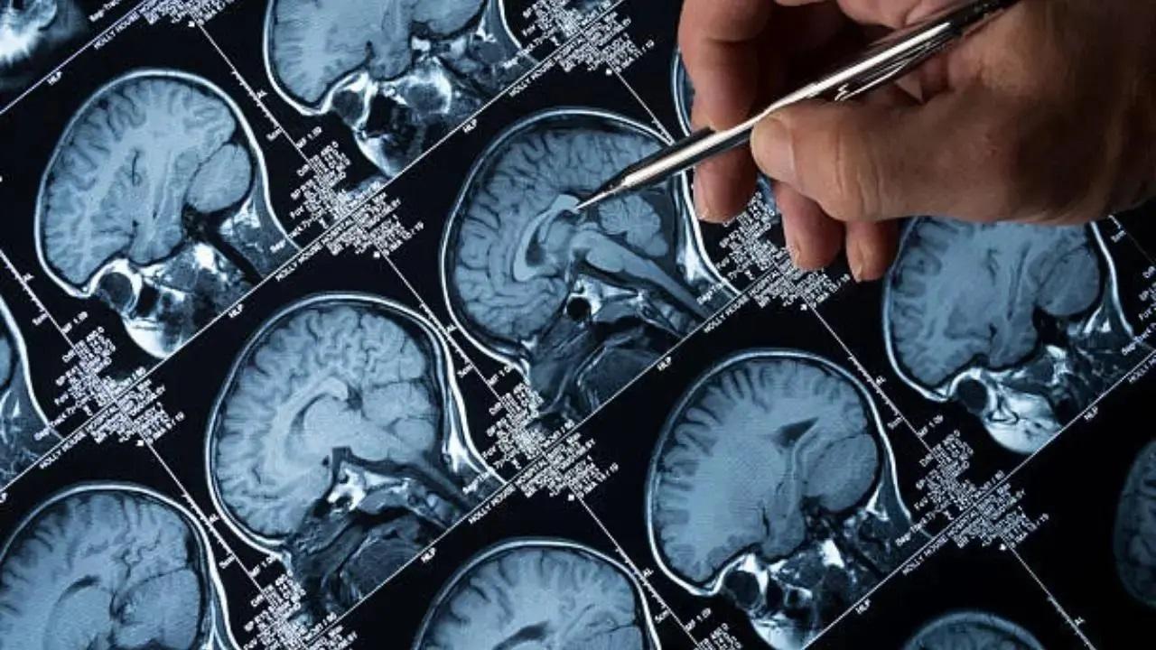 Men are three times more likely to die from a brain injury: Study